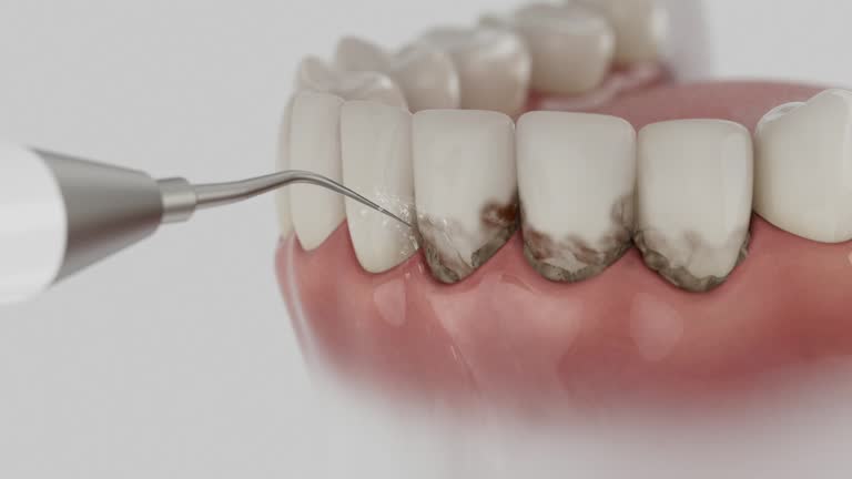 Reliable Tooth Extraction contractor in Campbell County County, VA by Dentist Open Now